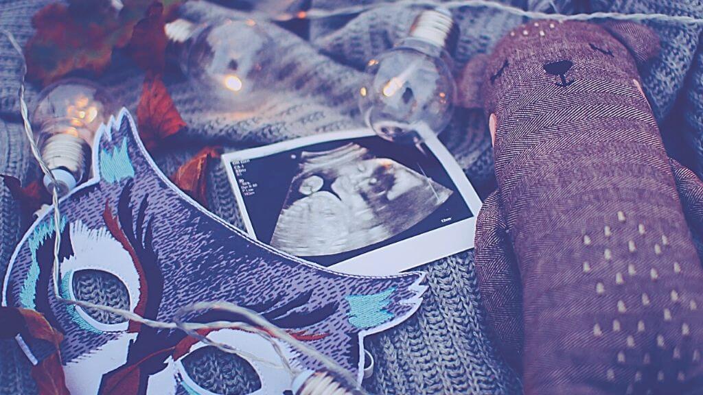 オランダで妊娠中期 週の胎児スクリーニング検査 ちび 海の外で生きる